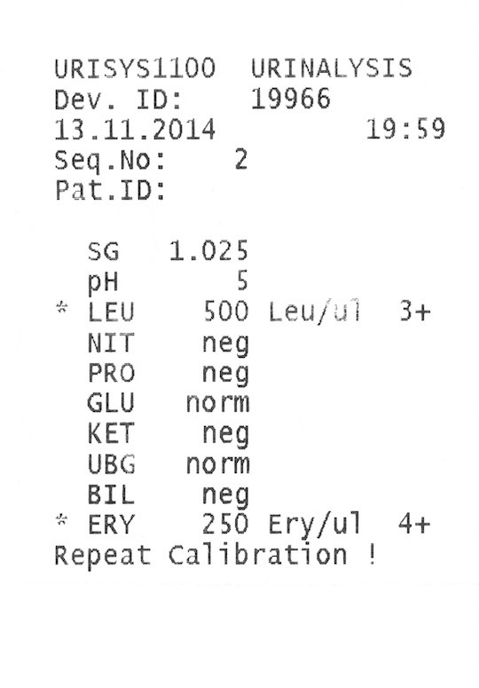 Inspiration: results of urine test for Bladder infection