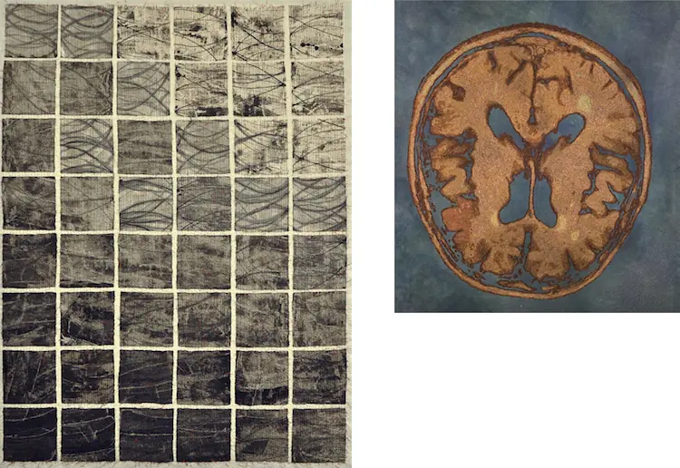 Karen Rips & Paula Chung, Losing His Mind and Alzheimers Brain, 2014
